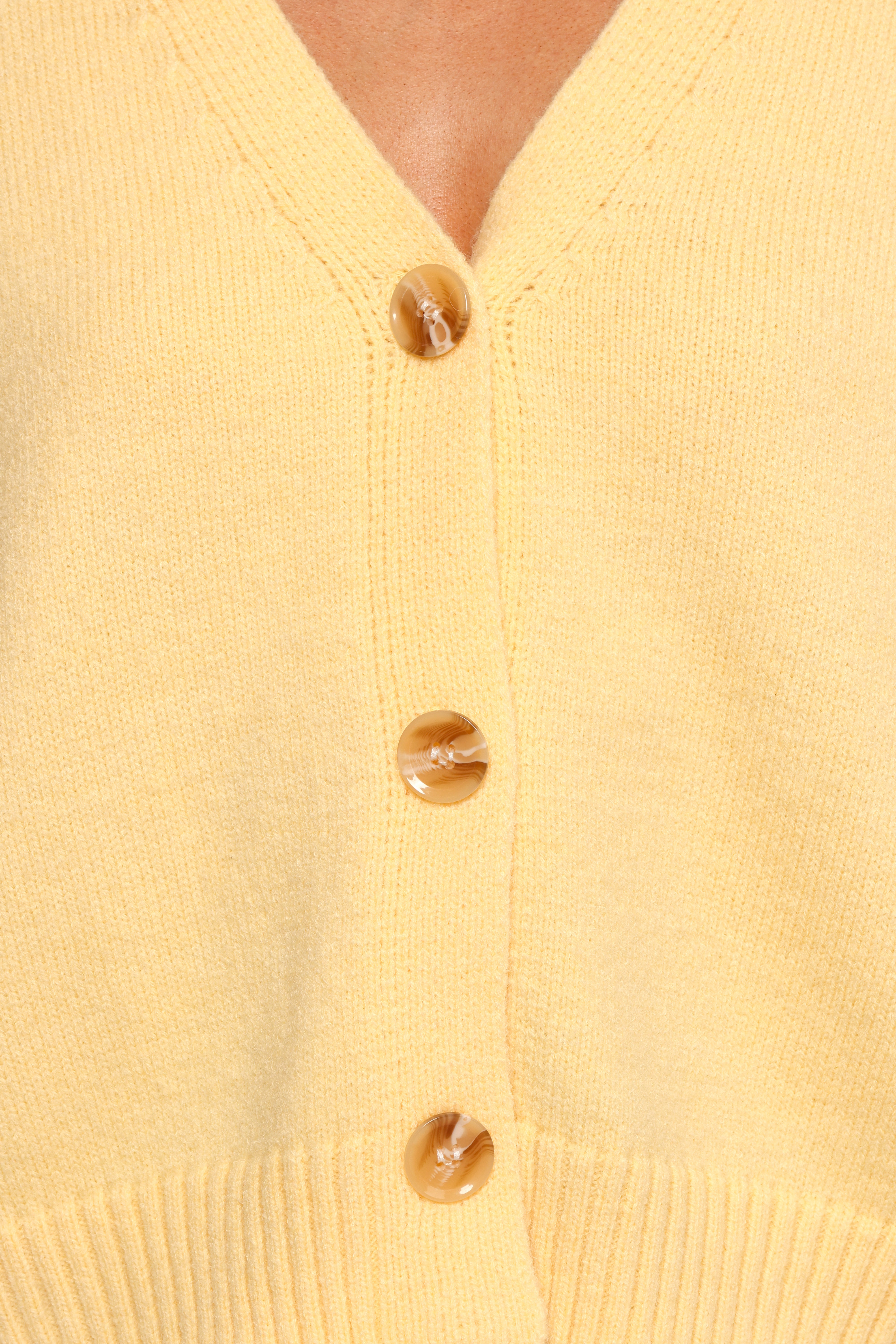 Yellow V-Neck Button Front Cardigan - Isabel